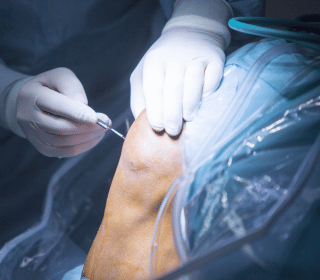 Arthroscopy