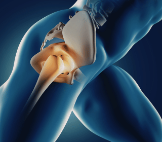 Joint Replacement