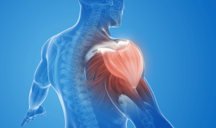 Shoulder Replacement